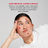Adesivos Secativos para Espinhas - Bye Bye Acne