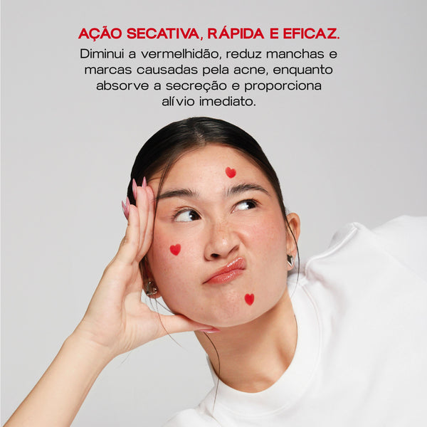 Adesivos Secativos para Espinhas - Bye Bye Acne